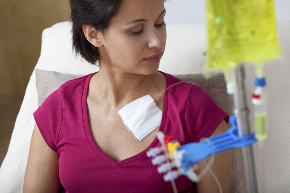 hôpitaux européens spécialisés dans le traitement des cancers. Femme recevant un traitement contre le cancer dans un hôpital européen.